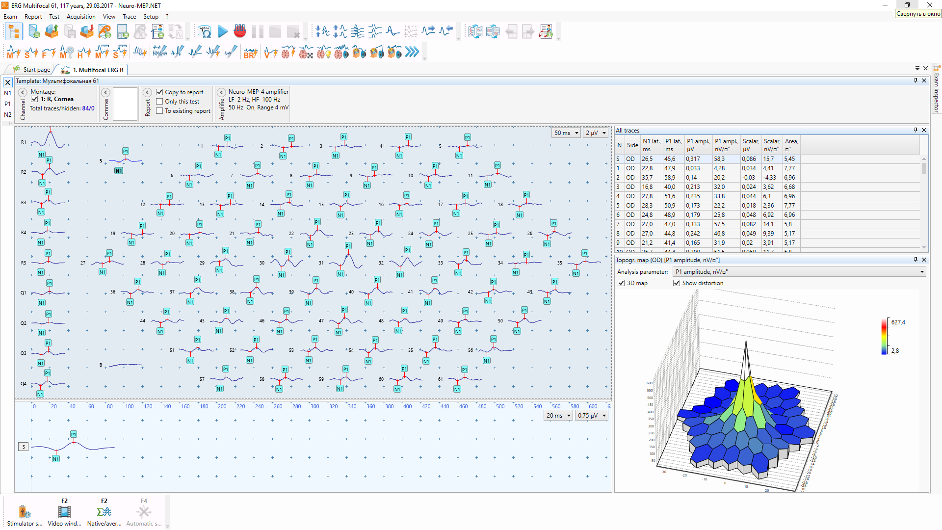 Мультифокальная ЭРГ на Нейро-ЭРГ